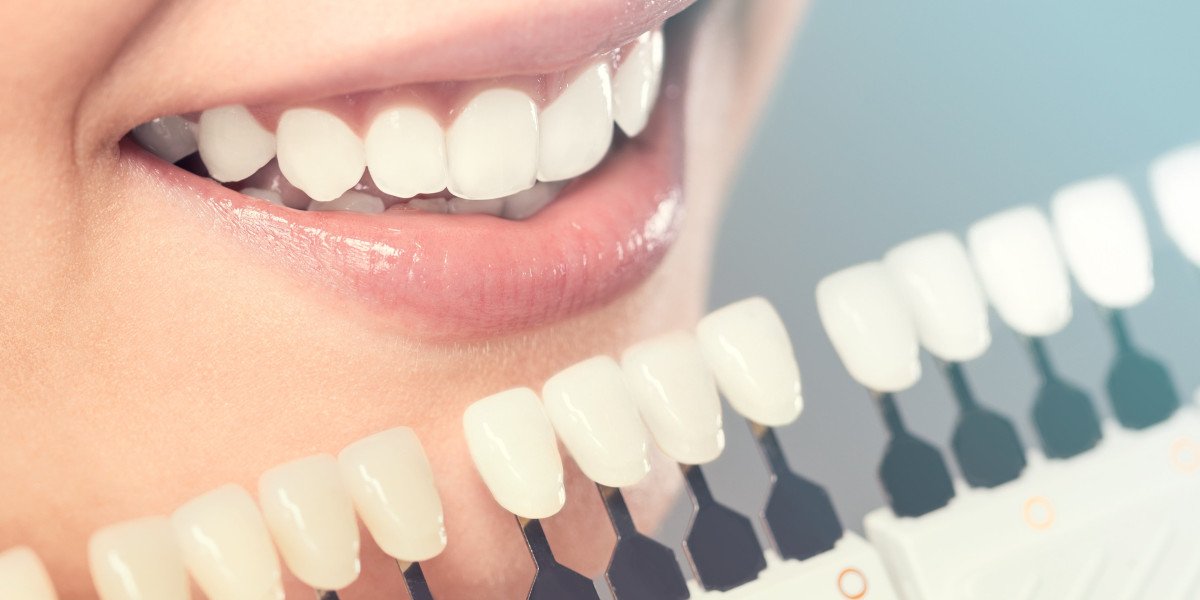 Restore Your Smile: Dental Implants in McKinney, Texas